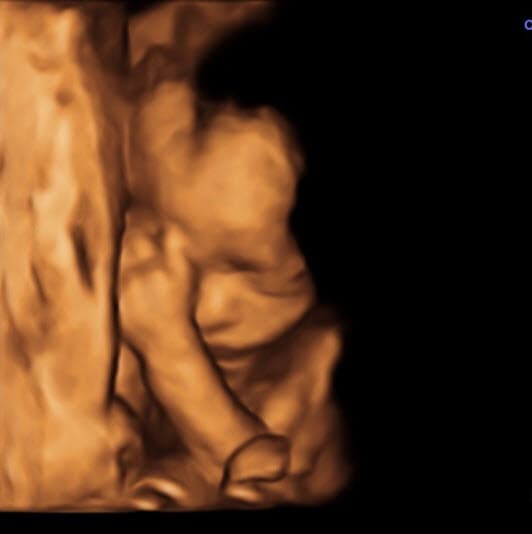 Fue en este momento que Marlene compartió la imagen del ultrasonido de Bella y escribió desde la cuenta de Instagram que abrió para su hija: "¡24 semanas en la barriga de mi mamá!".