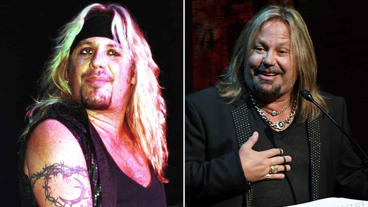 Otro que también ha cambiado drásticamente por culpa del bisturí es Vince Neil, vocalista de la agrupación de rock Mötley Crue. Aquí Dr. Feelgood no fue tan bueno después de todo.