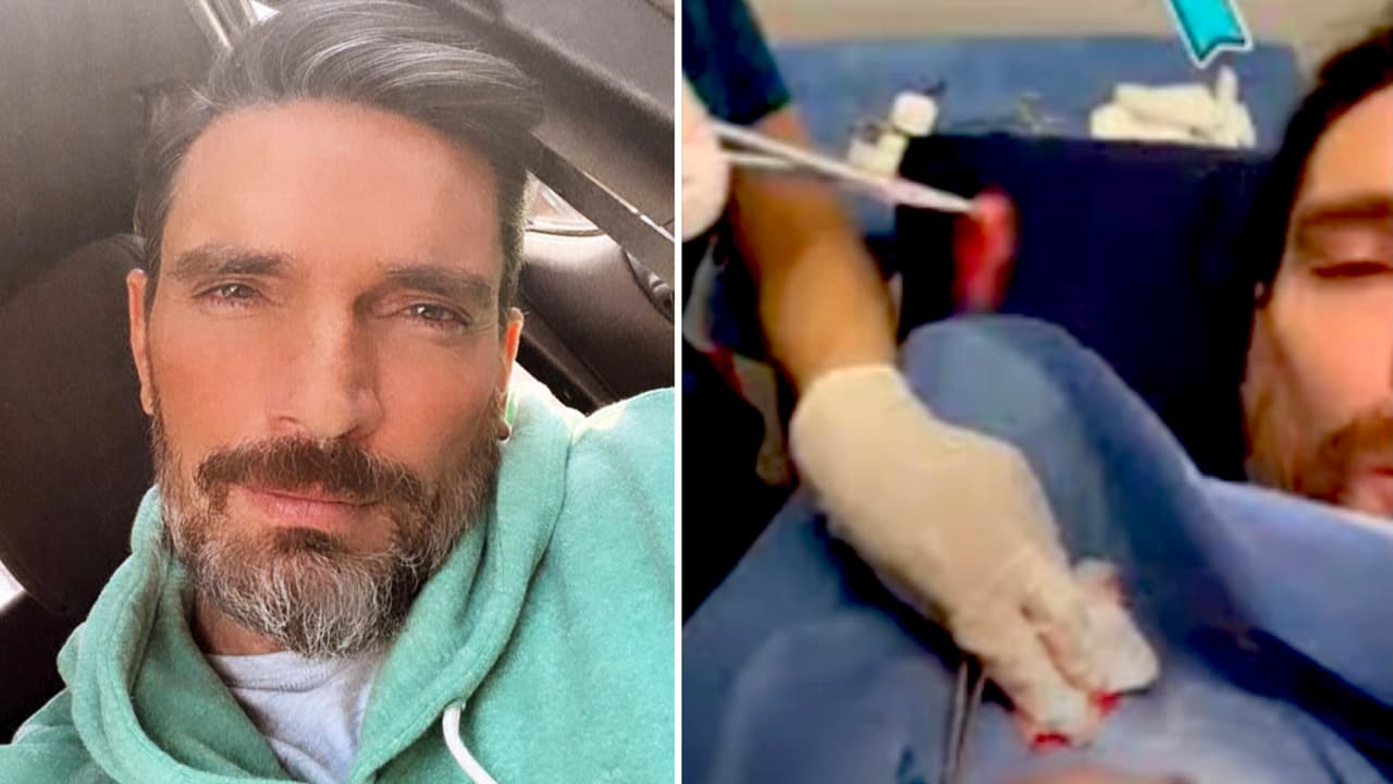 Julián Gil muestra sus grandes heridas de las cirugías por cáncer de piel