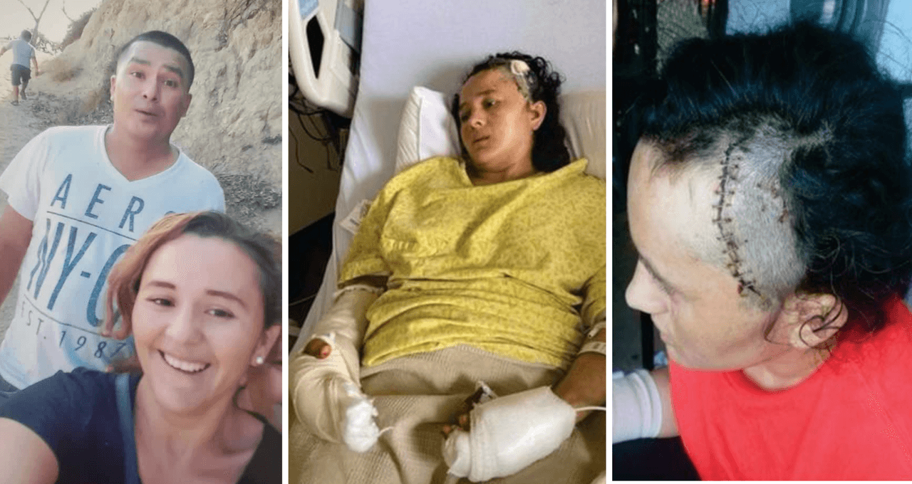 <b>"<a href="https://www.univision.com/local/los-angeles-kmex/hispana-narra-ataque-machete-esposo-crisis-mental">Tenía mirada de odio</a>"</b>. A finales de abril 2021, Dora Ramírez, de 37 años, contó a Univision34 Los Ángeles, cómo fue que su esposo las 
<b>agredió, a ella y a su hija, con un machete</b>.