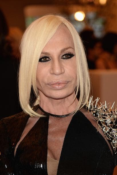 Pero cometió el peor error de su vida al inyectarse botox.