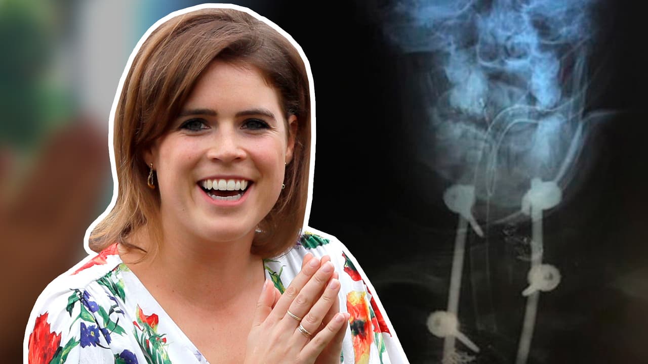 La princesa Eugenie revela su dolorosa enfermedad a través de Instagram