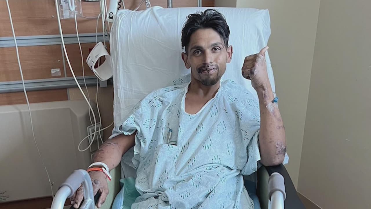 “Este no es el final”: joven venezolano cumple 80 días hospitalizado tras contagiarse con meningitis