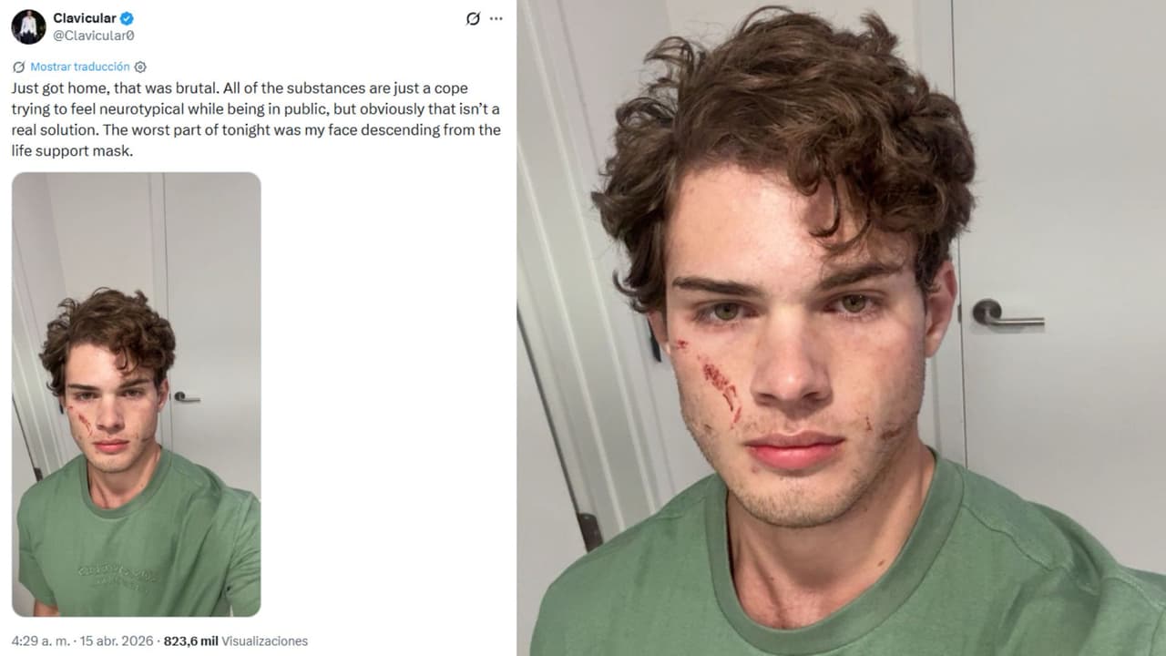 El 'influencer' Clavicular compartió que ya está en su casa.