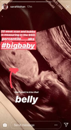 Su hijo tiene cinco meses de gestación y la modelo está ansiosa por conocerlo.