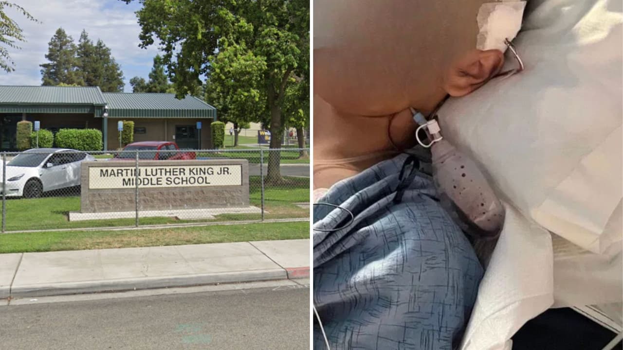 ¡Alertan! Reto de TikTok deja a un estudiante hispano en un hospital del centro de California