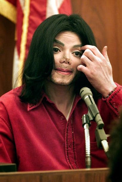 Además por su afición a los procedimientos estéticos, Michael sufría vitiligo.