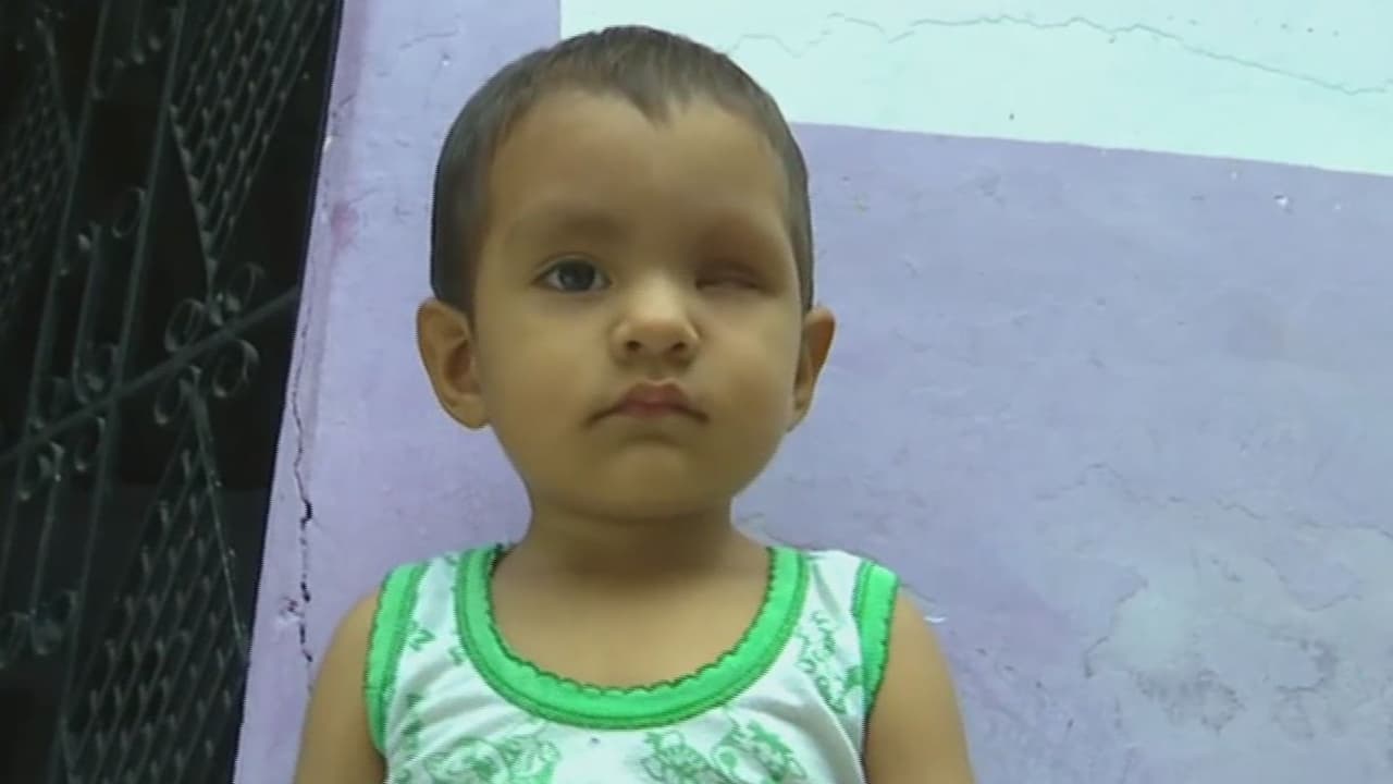 <b>A este niño le tuvieron que extirpar un ojo debido a un cáncer: su madre teme que pueda quedar ciego</b>
<br> 
<br>
<br>Los exámenes arrojaron que el cáncer le afectó el nervio óptico, por lo que su madre ahora busca recursos para que los médicos lo monitoreen constantemente y no le afecte el otro ojo.