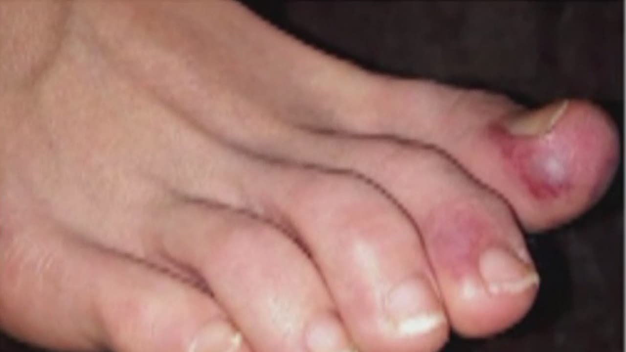 Por otra parte, un estudio realizado por siete científicas mexicanas y 
<a href="https://www.nature.com/articles/s41598-021-95565-8?fbclid=IwAR0QhtUqSAef-bcDGkHmX3QQpkT3DB6TUIeylfH6Qo6UtgbYQYVOS_QsnZg"><b>publicado en la revista especializada Nature</b></a>, reveló que el 80% de las personas que padecieron 
<a href="https://www.univision.com/temas/coronavirus">coronavirus</a> tienen al menos una secuela o efecto secundario a largo plazo.