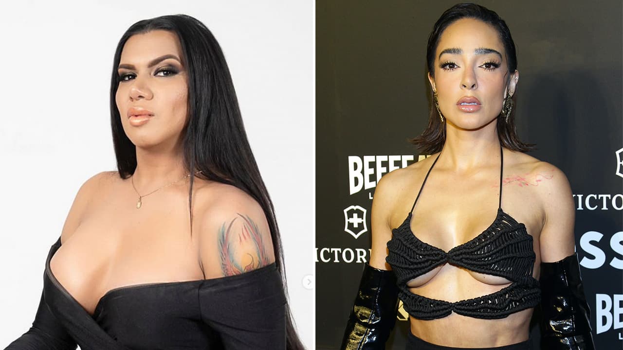 Famosas que estuvieron en peligro por una cirugía plástica: una de ellas hasta cayó en coma