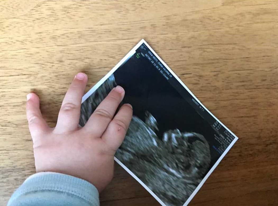 El pasado 6 de noviembre de 2018, Zuria compartió esta foto con sus seguidores a través de las redes sociales y anunció la espera de su segundo bebé.