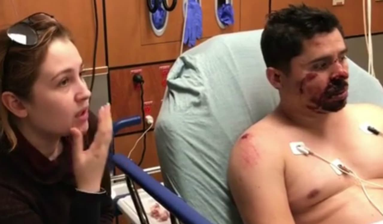 Larry se ha realizado varias cirugías por el accidente, pero aún no da a conocer a qué procesos estéticos se someterá para difuminar lo más que se pueda las cicatrices de su rostro.