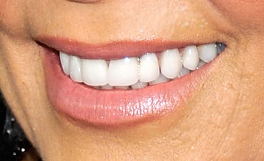 Te ponemos otro reto, ¿reconoces esta sonrisa? Es de una popular cantante mexicana que es dinamita pura sobre el escenario.