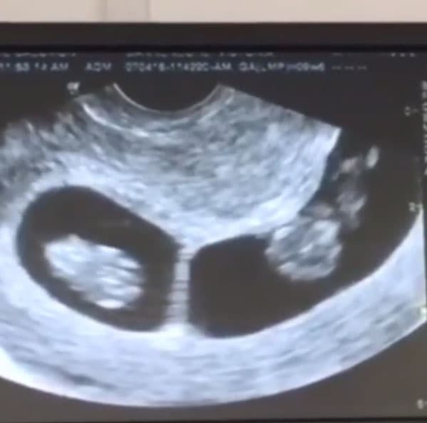 Osvaldo compartió el video del ultrasonido, donde se puede ver a los dos bebés: "La danza de gemelos #twins #bendecidos #gemelos #deleoncamacho #thankgod #babys #cubiertosconlasangredecristo #lifegoals gracias a la guerrera y mi reyna @camachovictoria".