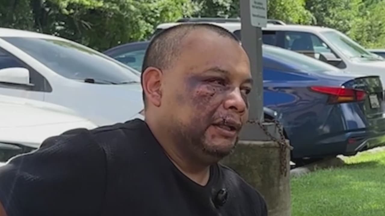 Caso José Mejía: Migrante Agredido por ICE Hospitalizado de Emergencia por Complicaciones