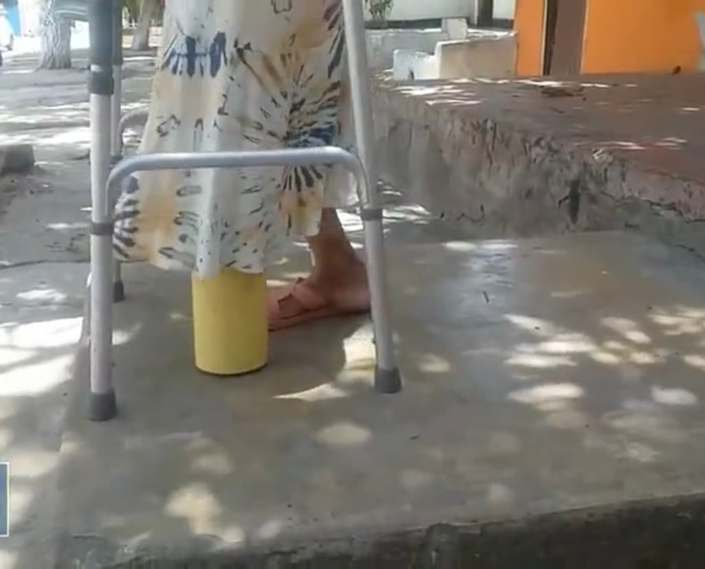 Ruth Cera, una 
<a href="https://www.univision.com/temas/colombia">colombiana </a>de 60 años, prefería tener un poco de dinero para mantener a sus tres hijas y a sus cuatro nietos, antes que preocuparse por las llagas que esos zapatos le habían provocado en su pie izquierdo y que su diabetes terminaría 
<b>por generarle una gangrena por la que habría que cortarle la mitad de la pierna. </b>
<br>