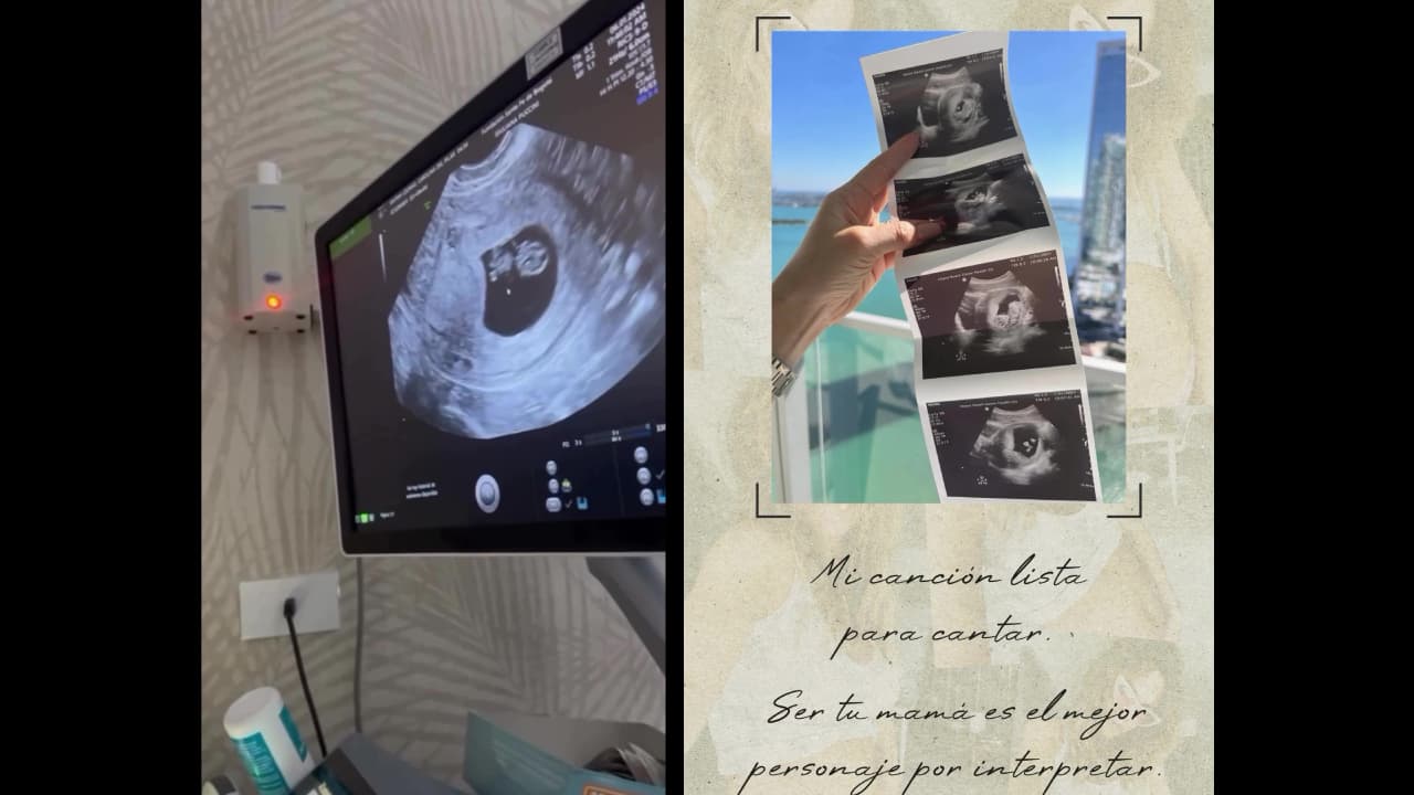 Actriz de Sin senos sí hay paraíso presume fotos de su bebé