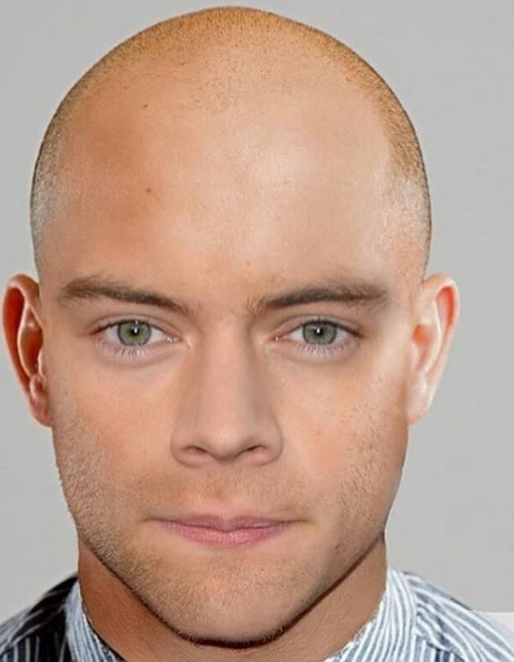 Otros incluso han ido al extremo... ¿será que en realidad se rapó?