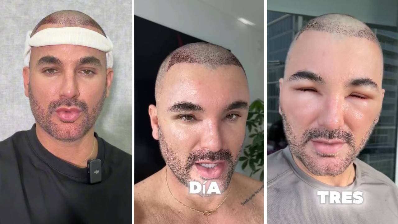 Mauricio Mejía día 1, 2 y 3.