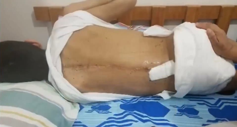 En una semana, Beyker y su madre tendrán que volver a Venezuela, por lo que esperan que en estos días puedan llegar hasta Chayanne, el sueño del joven, 
<b>para que pueda ayudarlo a lograr un reto más en su agitada vida. </b>
<br>