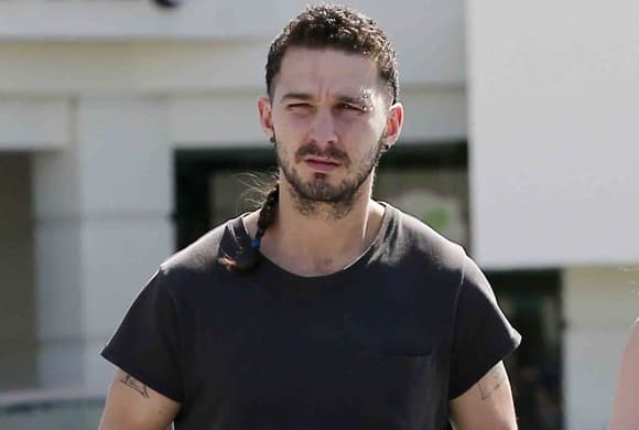 Shia LaBeouf hospitalizado por accidente en filmación