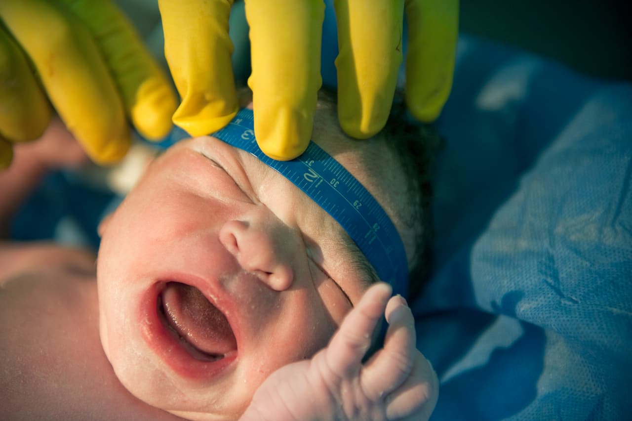 Obligadas a parir con VIH: mujeres en Venezuela que corren el riesgo de transmitir el virus a sus bebés 