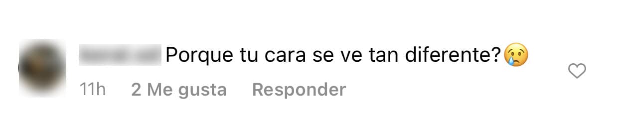 Otros seguidores no fueron tan críticos con ella y se limitaron a preguntarle sobre su físico de manera más mesurada, como por ejemplo "¿por qué su cara se ve tan diferente?". 
<br>