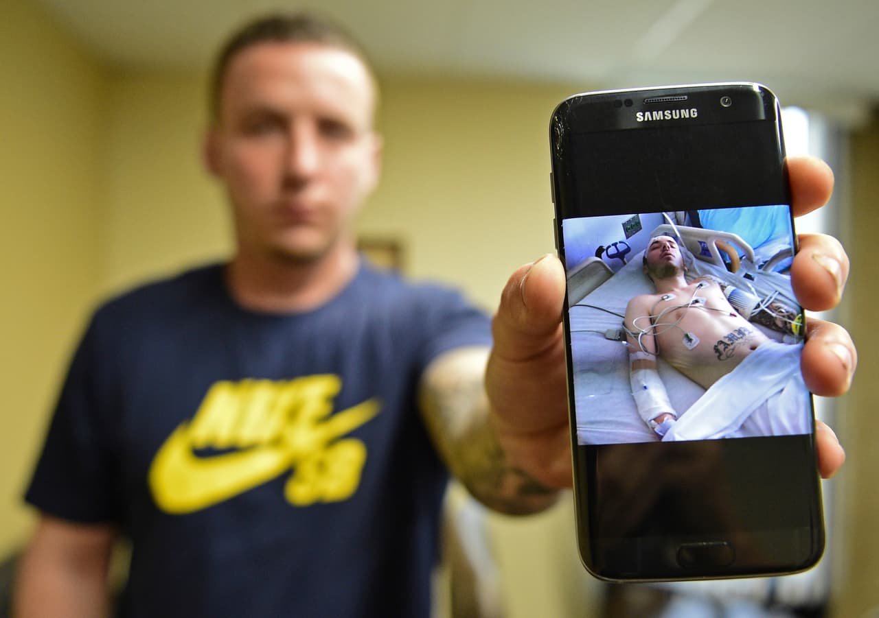 Un opioide aún más potente y peligroso es el carfetanilo, hasta 10,000 veces más fuerte que la morfina y 100 veces más que el fentanilo. 
<a href="https://www.nytimes.com/interactive/2017/06/05/upshot/opioid-epidemic-drug-overdose-deaths-are-rising-faster-than-ever.html?_r=0">17 personas experimentaron sobredosis y una murió</a> a las nueve horas de que el carfentanilo llegara a la ciudad de Akron, en 
<a href="http://www.univision.com/noticias/drogas-y-adicciones/en-fotos-ohio-el-desolador-reflejo-de-la-epidemia-de-los-opioides-fotos">Ohio</a>, uno de los estados más afectados por la crisis de opioides. En la foto, un adicto en recuperación (que no es más que una persona enferma) muestra la imagen del momento en que recibió cuidados luego de sufrir una sobredosis casi mortal.