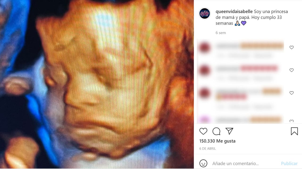 Fue ahí en donde el domingo 23 apareció la primera foto de la bebé. En la tarde de ese día, la cuenta
<b>tenía 79 mil seguidores. </b>
<br>