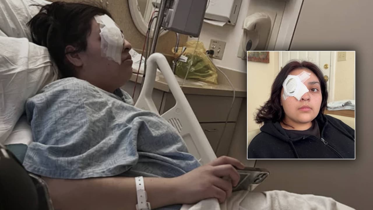 Gerente latina de restaurante pierde un ojo defendiendo a un niño con discapacidad