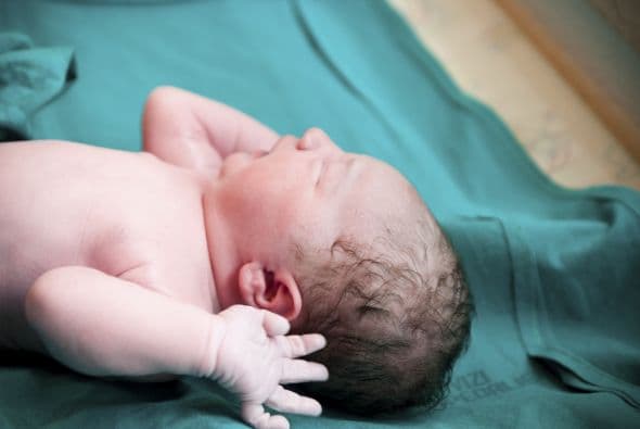 ‘The cord’. Muchas mujeres deciden conservar las células madre del cordón umbilical.