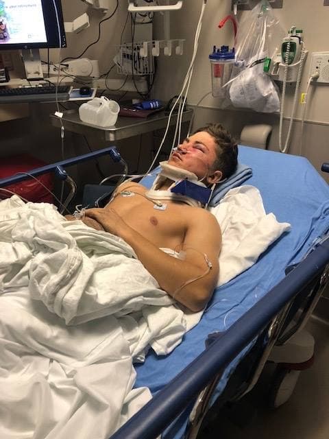 Casi pierde la vida al intentar tomarse un selfie y ahora busca orientar sobre su experiencia