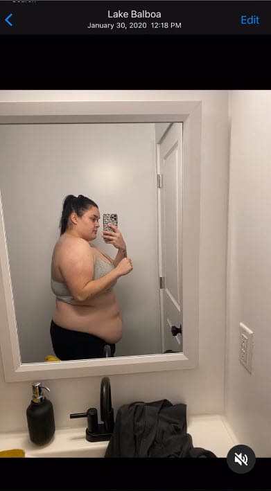 Una de las razones que la motivaron fue que, aunque ya había bajado de peso, el ejercicio no la ayudó con el exceso de piel. 
<br>