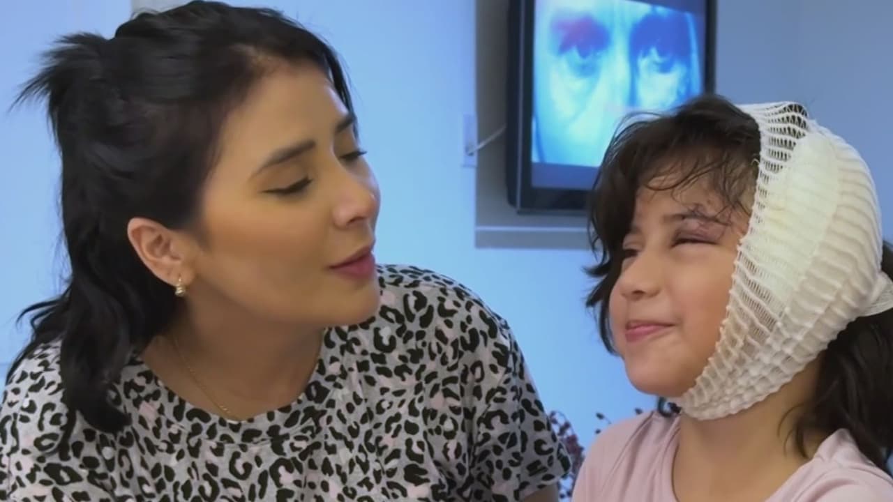 "Las heridas son profundas": habla la madre de la niña atacada por un perro pitbull en Hollywood