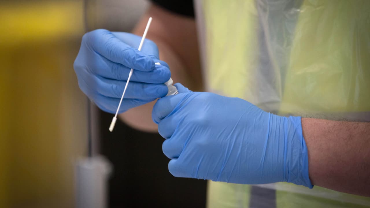 <b>En video: <b>Expertos temen por nuevos brotes de coronavirus en EEUU tras viajes y reuniones por 'Labor Day'</b></b>
<br>
<br>Ante los riesgos de contagios durante este fin de semana feriado, los Centros para el Control y Prevención de Enfermedades (CDC) han recomendado a personas no vacunadas que no viajen.