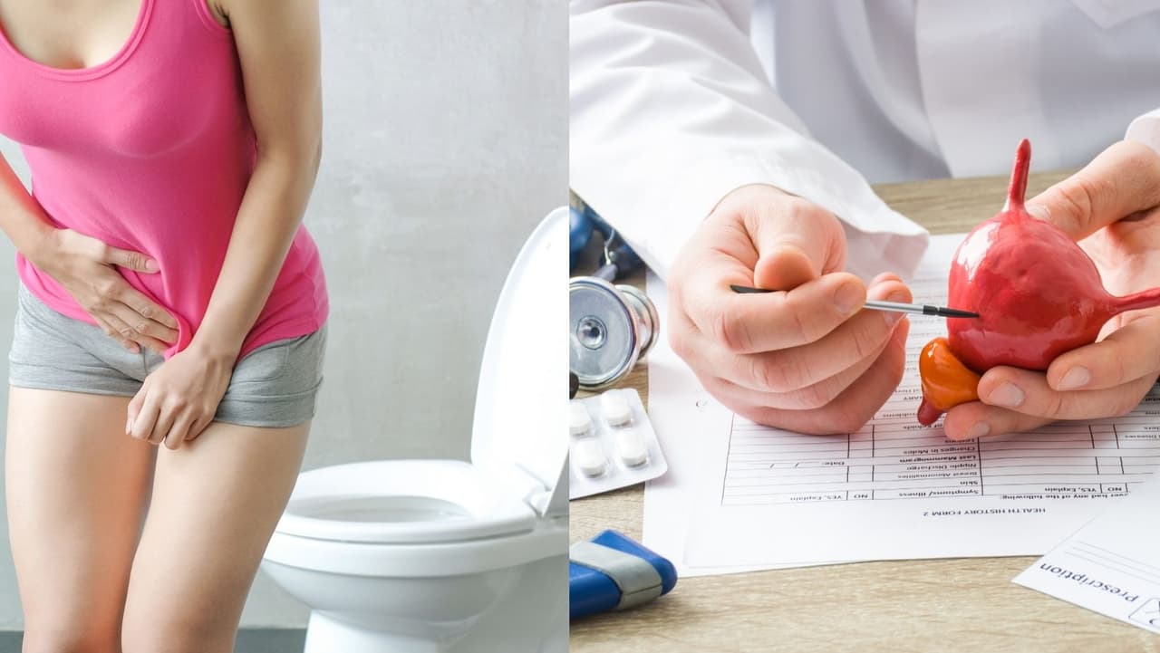 Estos son los 12 alimentos y bebidas que debes evitar si tienes la vejiga hiperactiva