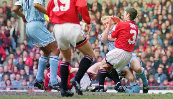 De las más fuertes en la historia del fútbol. David Busst, del Manchester City, chocó con un delantero del Manchester United y se fracturó de esta forma. No pudo volver a jugar.