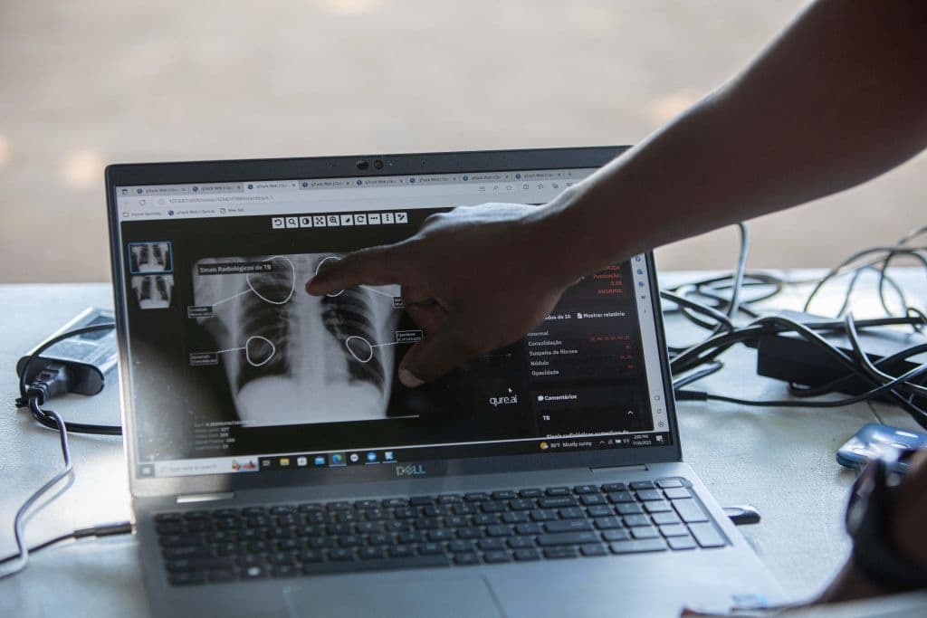 Reportan dos casos de tuberculosis en este distrito escolar de Houston
