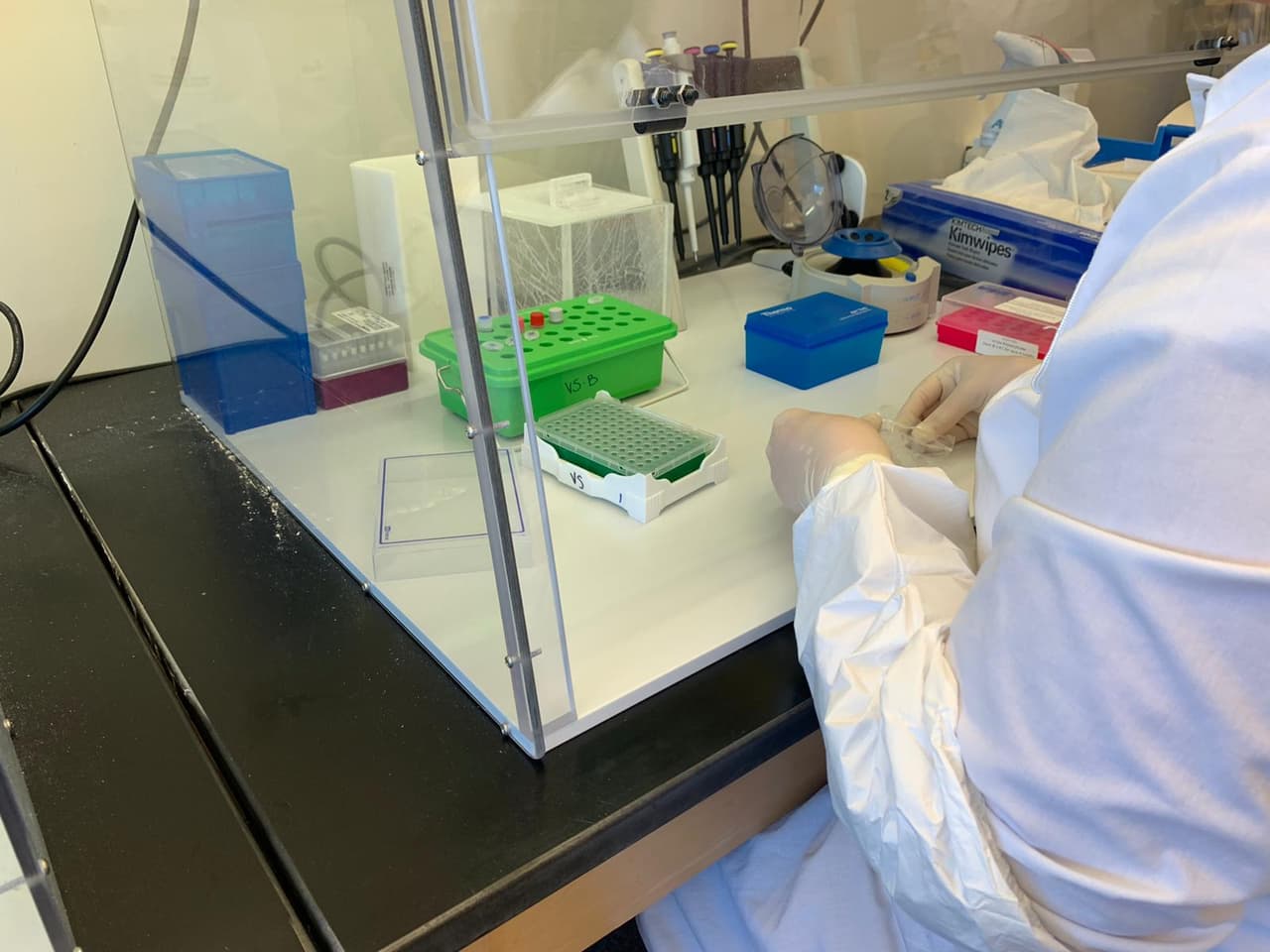 En un cuarto contiguo preparan la muestra que después colocan a una maquina que indicara los resultados en menos de 24 horas. Aún sabiendo si la muestra salió positiva al coronavirus por protocolo deben mandar esa muestra a los Centros de Control y Prevención de Enfermedades quienes confirmaran el resultado de forma definitiva.
<br>