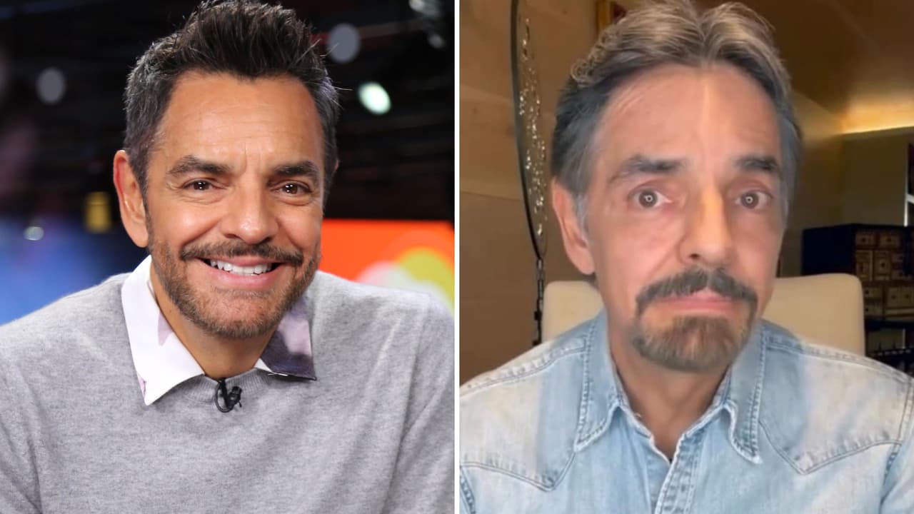 Eugenio Derbez preocupa al aparecer hinchado y con ‘bolitas’ en el rostro: esto le sucedió