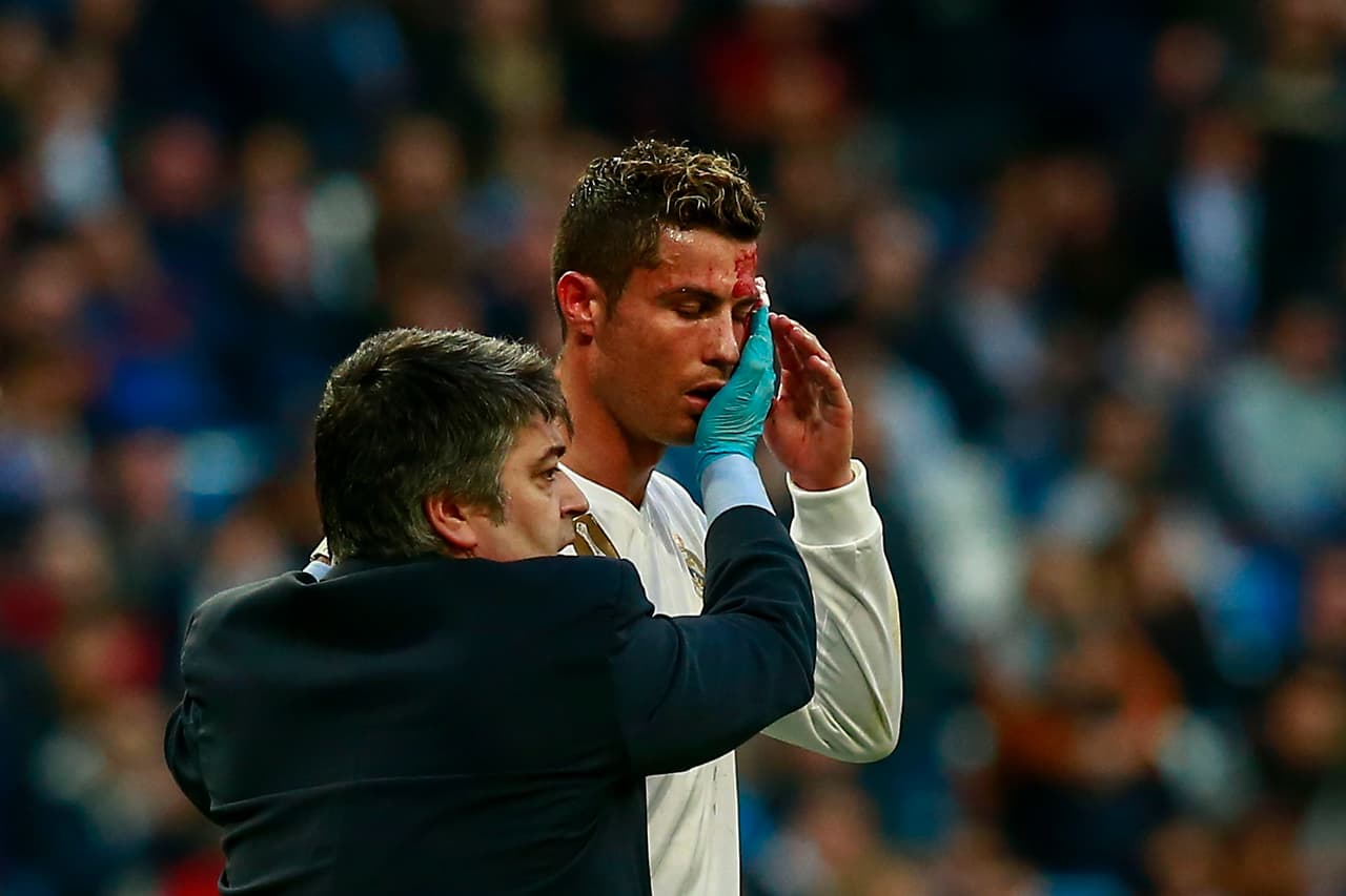 Cristiano se retiró con una cortada cerca del ojo izquierdo