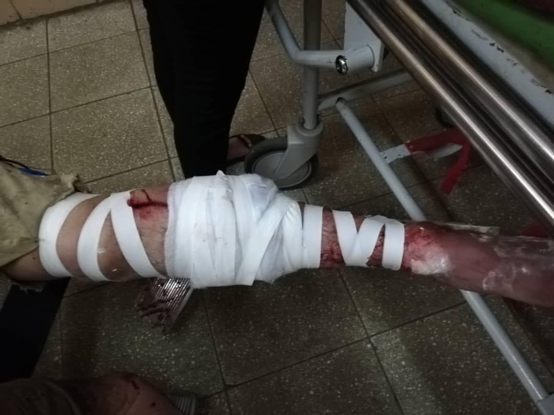 El accidente puede impedirle a Elija Pearson que vuelva a bailar como antes lo hacía.
<br>