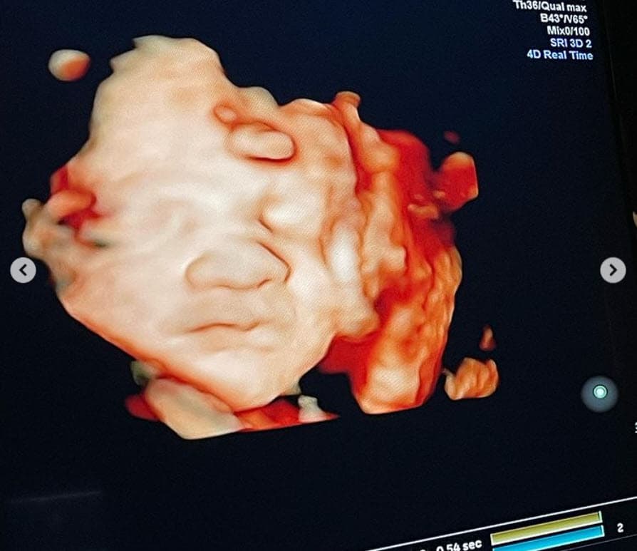 "¡Cada segundo de este viaje ha sido absolutamente increíble y estoy feliz de que sea solo el comienzo! ¡No puedo enfatizar lo emocionado que estoy por mi pequeña familia y lo ansioso que estoy de conocer a mi hermosa y pequeña niña!", escribió en inglés el hijo de Vanessa Guzmán.
<br>
<br>