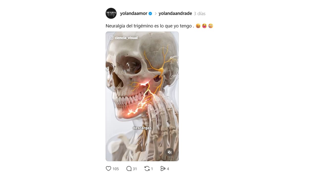 Así reveló Yolanda Andrade que fue diagnosticada con neuralgia del trigémino.