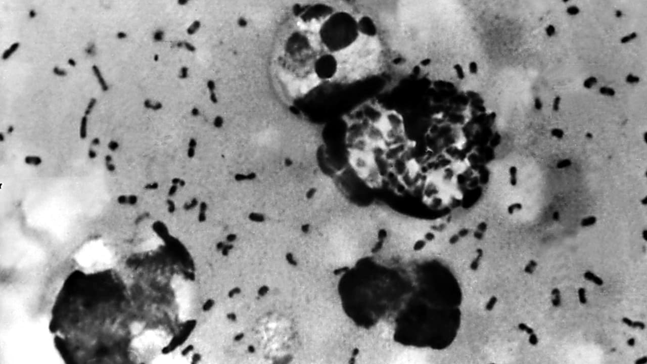 Descubren poderoso antibiótico que podría acabar con bacterias resistentes a medicamentos