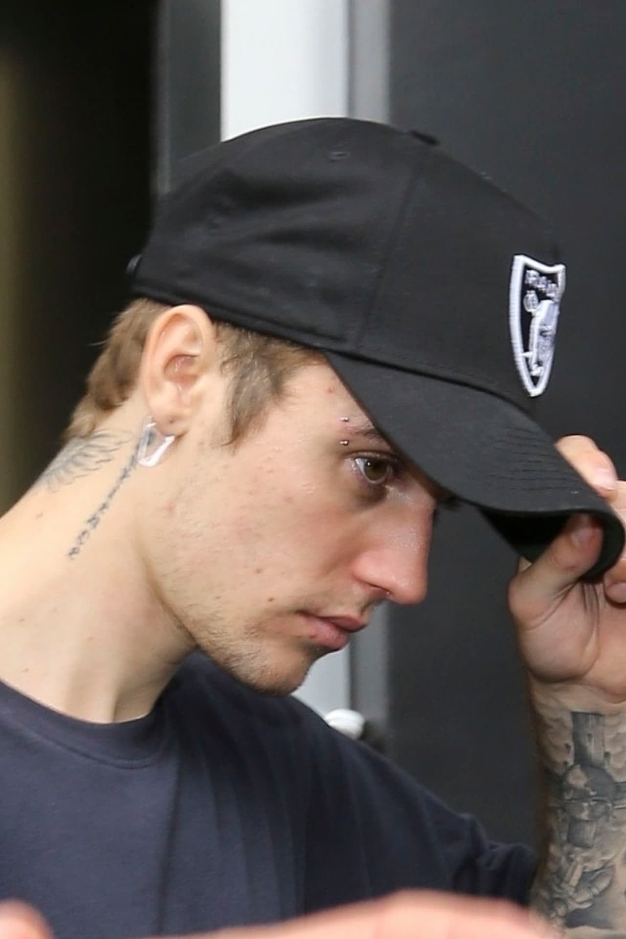 La agencia The Grosby Group afirma que Justin se dejó ver con estos parches después de un tratamiento para la piel con un dermatólogo de Los Ángeles.