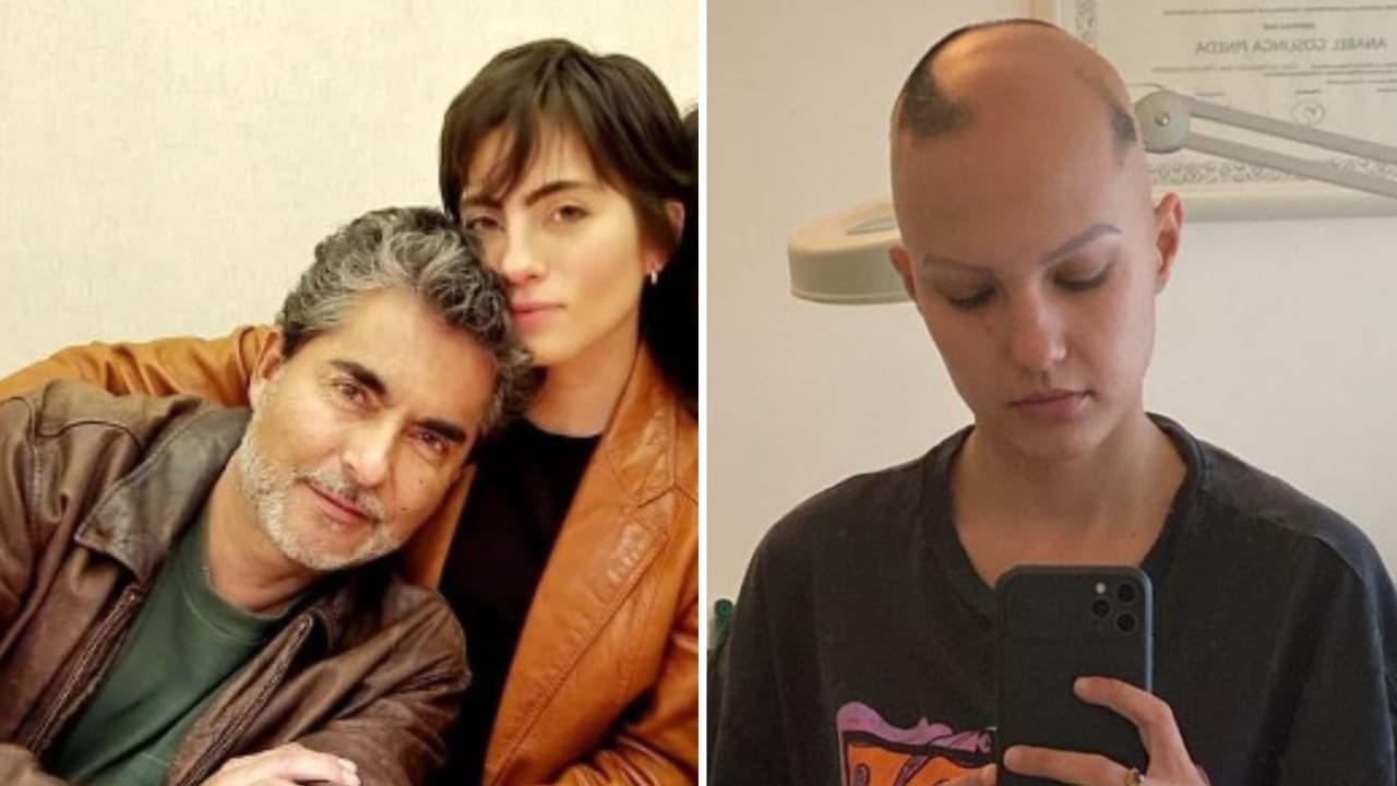 Novia de Camila Araiza, hija de Raúl Araiza, inicia tratamiento contra la alopecia: “A ver qué pasa”