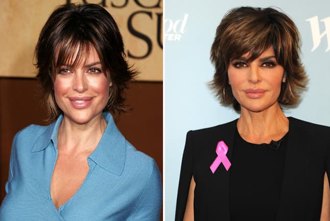 Muchos se rumoró que su aumento no fue de su total agrado, por lo que se sometió a una cirugía para volver a reducir el tamaño.