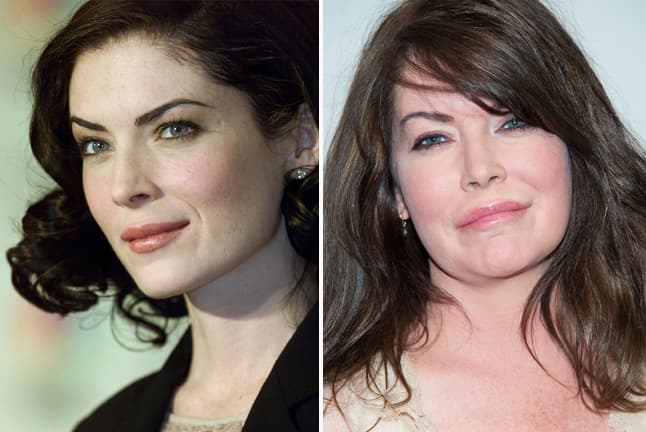 Hoy día sus hermosos rasgos han desaparecido y lo que queda es un rostro con exceso de cirugías.