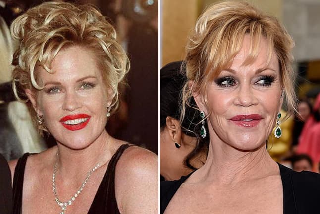 Vean la foto de su ayer, ¿ustedes creen que era necesario que transformara de esa manera sus labios?